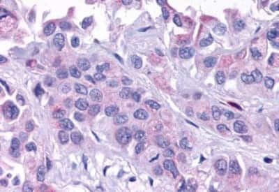 Immunohistochemistry-Paraffin: ELTD1/ETL Antibody [NBP3-14306]